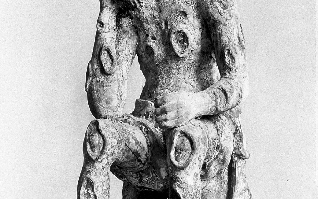 Statuette of Job, showing syphilis ulcers. Front view. From a French church.